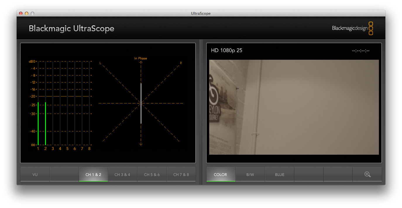 ultrascope_76_line_tone.png